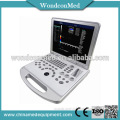 Handheld doppler ultrasound machine for surgery